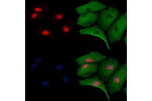 ABIN6263195 and ABIN6279528 staining  cells by IF/ICC.