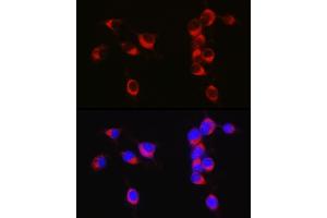 Immunofluorescence analysis of Neuro-2a cells using  Rabbit pAb (ABIN6129958, ABIN6136993, ABIN6136994 and ABIN6222595) at dilution of 1:50 (40x lens).