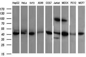 Image no. 5 for anti-Acetyl-CoA Acyltransferase 2 (ACAA2) antibody (ABIN1495723)