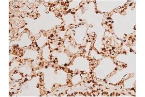 ABIN6267523 at 1/200 staining Rat lung tissue sections by IHC-P.