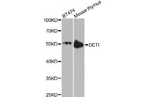 Western blot analysis of extracts of various cell lines, using DET1 antibody. (DET1 anticorps  (AA 15-240))