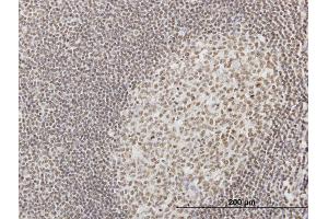 Immunoperoxidase of monoclonal antibody to IFI16 on formalin-fixed paraffin-embedded human tonsil. (IFI16 anticorps  (AA 630-729))