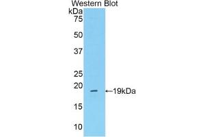 Western blot analysis of the recombinant protein. (Mannose Associated Serine Protease 2 (AA 280-433) anticorps)