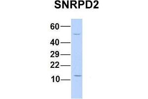 Host:  Rabbit  Target Name:  SNRPD2  Sample Type:  Human 293T  Antibody Dilution:  1. (SNRPD2 anticorps  (N-Term))