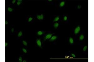 Image no. 3 for anti-RNA Guanine-7 Methyltransferase (RNMT) (AA 1-477) antibody (ABIN599057) (RNMT anticorps  (AA 1-477))