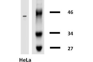 Western blotting analysis of human cytokeratin 18 using mouse monoclonal antibody DA-7 on lysates of HT-29 cell line and MOLT-4 cell line (cytokeratin non-expressing cell line, negative control) under non-reducing and reducing conditions. (Cytokeratin 18 anticorps  (Biotin))