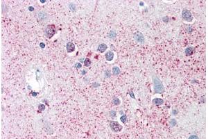 Anti-SRPX2 antibody  ABIN960820 IHC staining of human brain, cortex.