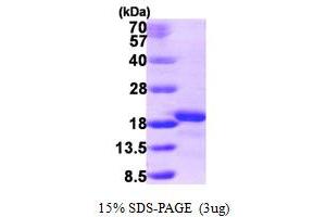 SDS-PAGE (SDS) image for Ionized Calcium-binding Adapter Molecule 2 (IBA2) (AA 1-150) protein (His tag) (ABIN667330)