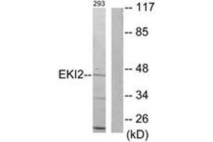 Western blot analysis of extracts from 293 cells, using EKI2 Antibody. (Ethanolamine Kinase 2 anticorps  (AA 51-100))