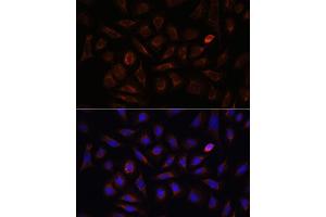 Immunofluorescence analysis of U-2 OS cells using Neuropilin-1 (Neuropilin-1 (NRP1)) antibody (ABIN7268892) at dilution of 1:100.