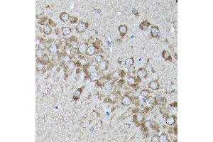 Immunohistochemistry of paraffin-embedded rat brain using SNAPIN Rabbit pAb  at dilution of 1:200 (40x lens).
