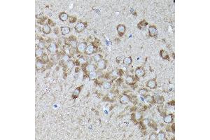 Immunohistochemistry of paraffin-embedded rat brain using SNAPIN Rabbit pAb  at dilution of 1:200 (40x lens). (SNAPIN anticorps  (AA 1-136))