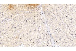 Detection of a1AGP in Human Liver Tissue using Monoclonal Antibody to Alpha-1-Acid Glycoprotein (a1AGP)