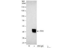 IP Image Immunoprecipitation of GLA protein from 293T whole cell extracts using 5 μg of Galactosidase alpha antibody [N1C2], Western blot analysis was performed using Galactosidase alpha antibody [N1C2], EasyBlot anti-Rabbit IgG  was used as a secondary reagent. (GLA anticorps)