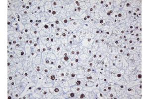 Image no. 2 for anti-Decapping Enzyme, Scavenger (DCPS) antibody (ABIN1497780) (DCPS anticorps)
