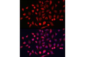 Immunofluorescence analysis of A-549 cells using Cytokeratin 16 (KRT16) Rabbit pAb (ABIN6129541, ABIN6143021, ABIN6143022 and ABIN6223391) at dilution of 1:200 (40x lens). (KRT16 anticorps  (AA 190-430))