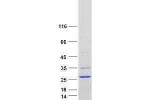 Validation with Western Blot