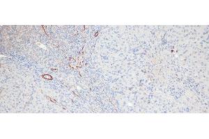Immunohistochemistry of paraffin-embedded Rat ovary using Phospho-MYL9(T18/S19) Polyclonal Antibody at dilution of 1:100 (20x lens).