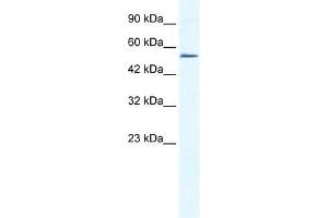 Western Blot showing ZNF286 antibody used at a concentration of 1-2 ug/ml to detect its target protein.