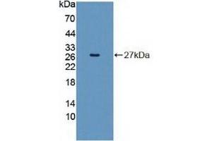 Detection of Recombinant INSRR, Human using Polyclonal Antibody to Insulin Receptor Related Receptor (INSRR) (INSRR anticorps  (AA 1090-1295))