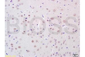 Formalin-fixed and paraffin embedded rat brain tissue labeled with Anti-BRN3A Polyclonal Antibody, Unconjugated (ABIN702400) at 1:100 followed by conjugation to the secondary antibody, (SP-0023), and DAB staining (POU4F1 anticorps  (AA 325-419))
