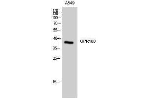 Western Blotting (WB) image for anti-Relaxin/insulin-Like Family Peptide Receptor 4 (RXFP4) (C-Term) antibody (ABIN3184827) (RXFP4 anticorps  (C-Term))