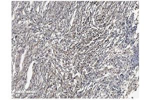IHC analysis of SHANK3 using anti SHANK3 antibody (ABIN7600006).