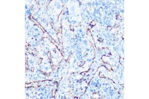 Immunohistochemistry of paraffin-embedded rat spleen using Caveolin-1 Rabbit pAb (ABIN6131271, ABIN6137992, ABIN6137993 and ABIN6218615) at dilution of 1:100 (40x lens).