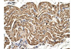 ATP5B antibody was used for immunohistochemistry at a concentration of 4-8 ug/ml to stain Skeletal muscle cells (arrows) in Human Muscle.