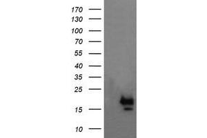Image no. 1 for anti-NFKB Inhibitor Interacting Ras-Like 1 (NKIRAS1) antibody (ABIN1499743) (NKIRAS1 anticorps)