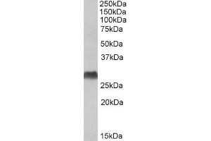 ABIN571247 (1µg/ml) staining of Human Bone Marrow lysate (35µg protein in RIPA buffer). (HLA-DQA2 anticorps  (C-Term))