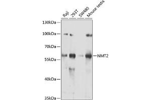 Western blot analysis of extracts of various cell lines, using NMT2 antibody (ABIN6130572, ABIN6144688, ABIN6144690 and ABIN6222825) at 1:1000 dilution. (NMT2 anticorps  (AA 1-120))