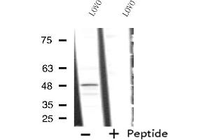 Western blot analysis of extracts from LOVO cells, using RAD23A antibody. (RAD23A anticorps  (C-Term))