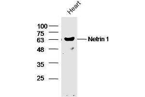 Mouse heart lysates probed with Rabbit Anti-Netrin 1 Polyclonal Antibody, Unconjugated  at 1:5000 for 90 min at 37˚C. (Netrin 1 anticorps  (AA 501-604))