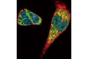 Immunofluorescence (IF) image for anti-Midkine (Neurite Growth-Promoting Factor 2) (MDK) antibody (ABIN2996524) (Midkine anticorps)