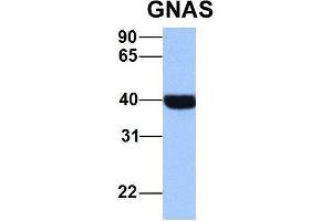 Host:  Rabbit  Target Name:  NOP56  Sample Type:  MCF7  Antibody Dilution:  1.