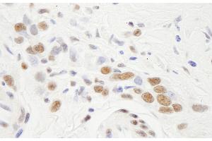 Immunohistochemistry (IHC) image for anti-Nuclear Transcription Factor Y, alpha (NFYA) (AA 333-347) antibody (ABIN7448690) (NFYA anticorps  (AA 333-347))