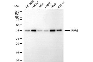 anti-Purine-Rich Element Binding Protein B (PURB) antibody