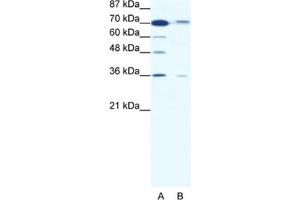 Western Blotting (WB) image for anti-SMAD Family Member 4 (SMAD4) antibody (ABIN2460350) (SMAD4 anticorps)