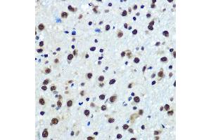 Immunohistochemistry of paraffin-embedded rat brain using hnRNP K Rabbit mAb (ABIN7267634) at dilution of 1:100 (40x lens). (HNRNPK anticorps)