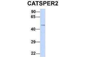 Host:  Rabbit  Target Name:  CATSPER2  Sample Type:  Human 293T  Antibody Dilution:  1. (CATSPER2 anticorps  (N-Term))