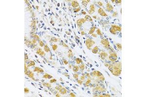 Immunohistochemistry of paraffin-embedded human stomach using PSG1 antibody at dilution of 1:100 (40x lens). (PSG1 anticorps)
