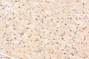 Immunohistochemistry analysis of paraffin-embedded mouse heart using,NOS1AP (ABIN7074844) at dilution of 1: 4000 (NOS1AP anticorps)