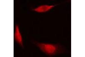 ABIN6278564 staining Hela cells by IF/ICC.