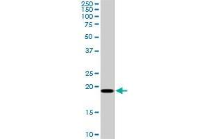 SRI monoclonal antibody (M01), clone 1E12.