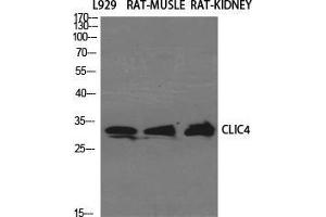 Western Blot (WB) analysis of specific cells using CLIC4 Polyclonal Antibody.