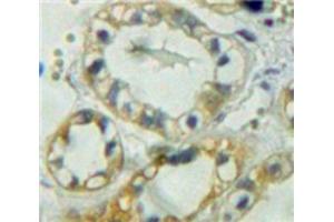 Used in DAB staining on fromalin fixed paraffin-embedded Kidney tissue (PTPRM anticorps  (AA 1197-1403))