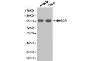 Western Blotting (WB) image for anti-3-Hydroxy-3-Methylglutaryl-CoA Reductase (HMGCR) antibody (ABIN1873048)