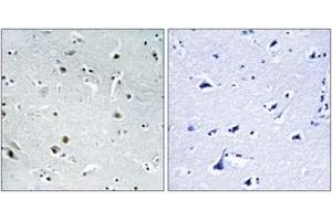 Immunohistochemistry (IHC) image for anti-DEAD (Asp-Glu-Ala-Asp) Box Polypeptide 24 (DDX24) (AA 41-90) antibody (ABIN2890149)