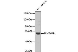 Western blot analysis of extracts of Mouse liver using TRMT61B Polyclonal Antibody at dilution of 1:1000.